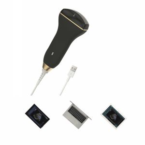 China Digital Smart Handheld Ultrasound Scanner Wireless Ultrasound Probe For Puncture Guidance factory