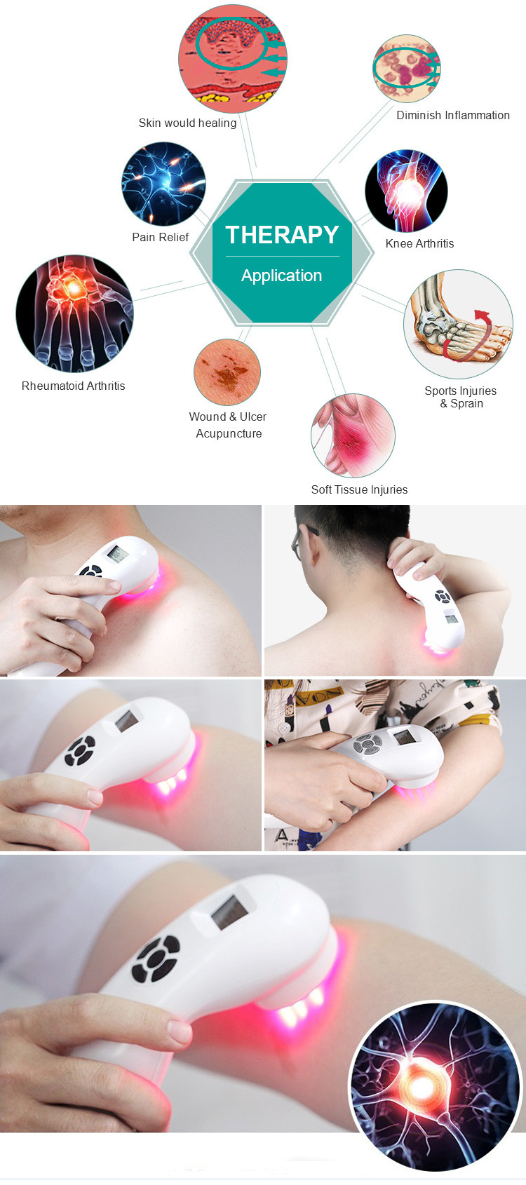 808nm 650nm Medical Healthcare Equipment Pain Relief Handheld Cold Laser Therapy Device