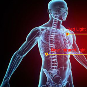 Red light therapy