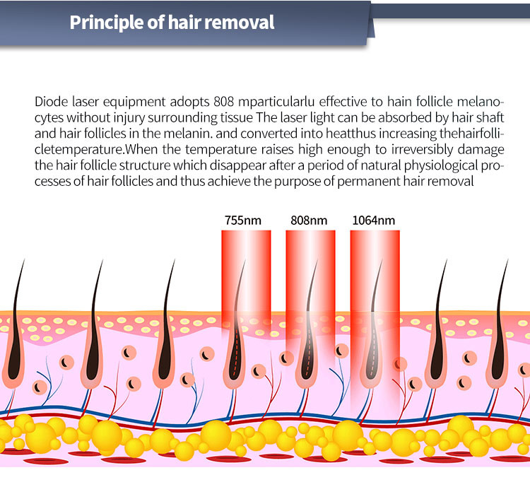 1200w/1600w Triple Wavelength Diode Laser Hair Removal Beauty Machine 755nm 808nm 1064nm