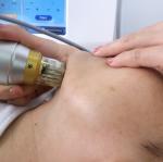 4 hands Deep Heat Microneedling Fractional RF Beauty Facial Machine