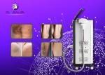 Micro Channel 808nm Diode Laser Hair Removal Machine Stationary Style