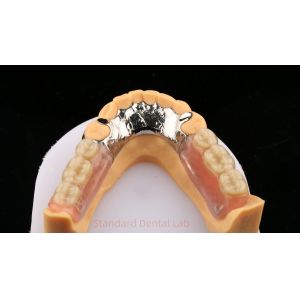 China Metal Alloys Cobalt Chromium Partial Denture Ivoclar Scheftner Comfortable Cast Metal Framewrok factory