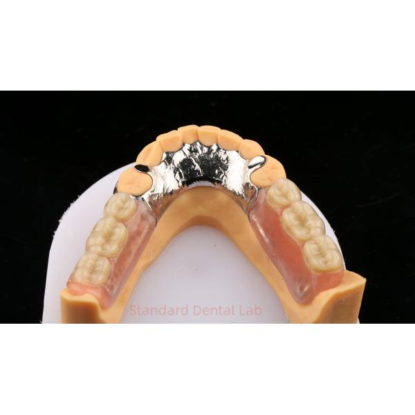 Metal Alloys Cobalt Chromium Partial Denture Ivoclar Scheftner Comfortable Cast Metal Framewrok