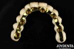 Custom-made Ti-Bar Zirconia Hybrid Bridge The Perfect Combination For Comfort