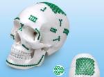 110 Degree L Plate Orthopedic Maxillofacial Implants Left Right