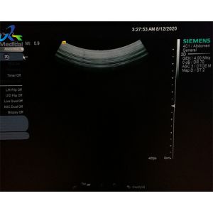 Cypress 4C1 Convex Ultrasound Transducer Probe Abdominal Vascular Hospital