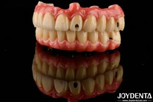 China Excellent Elasticity Dental Acrylic Denture Finish with Lightweight Property factory