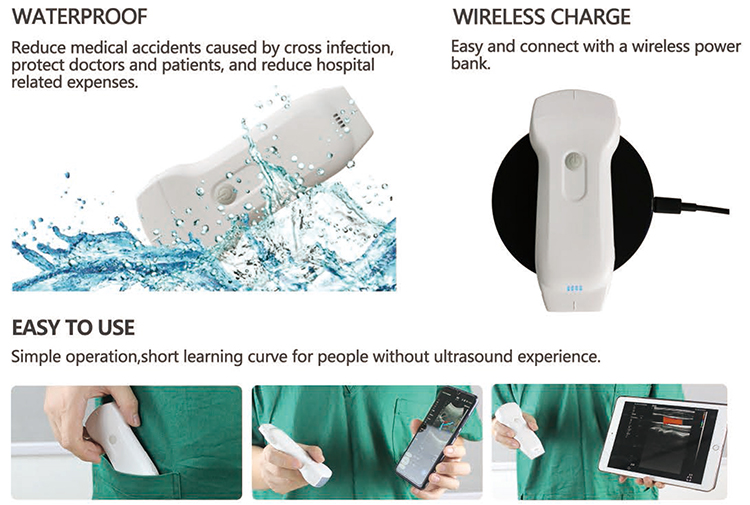 Dual Portable Wireless Ultrasound Liner Probe 3 in 1