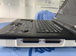 Win7 System Portable Color Doppler Ultrasound Scanner 3200mAh Battery