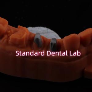 China Metal Post Core Crown CAD CAM Porcelain / Zirconia Coping Full Zircnonia Bruxier Crowns factory