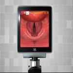 3 Sizes Disposable Video Laryngoscope Equipment 2M Resolution