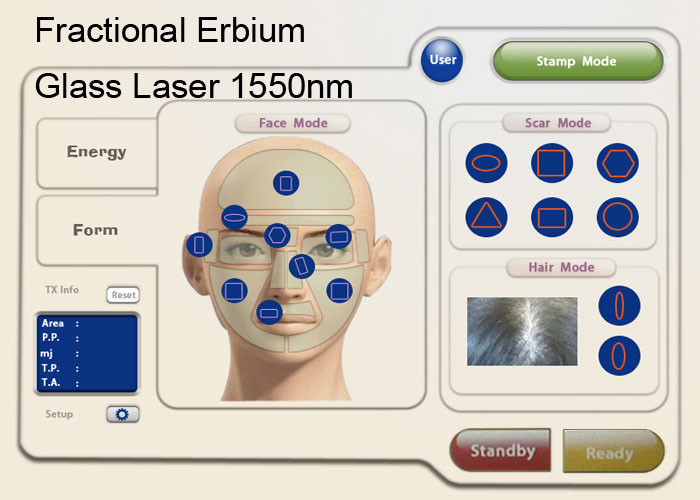 1550nm Erbium Glass Laser For Acne Scars Discoloration Melasma Scar Removal Laser Machine