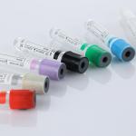 Disposable Vacuum Blood Collection Tube Hospital Laboratory Blood Collection