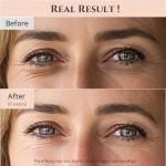 30ml Revive Eye Serum For Puffy Eye Bags Fine Lines Dark Circles Wrinkles