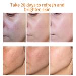 OEM Facial Moisturizing Cream Brightening Anti Wrinkle Spot Removing Cream