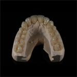 Personalized Strong Ceramic Zirconia Dental Crown Full Mouth Full Contour