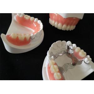 Custom Smooth Surface CAD CAM PFM Crown Bridge High Definition