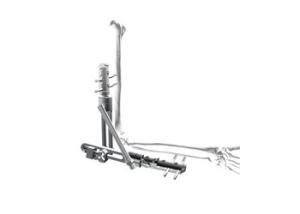 China Precision Distal Radius External Fixator , Orthopedic Surgical Instruments factory