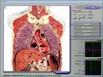 3d Nls Health Analyzer , Body Scanner For Health Examination Centre