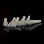 Dental Lab Teeth Feldspathic Porcelain Veneers Custom Shaped