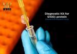 S100-β Rapid Quantitative Test Kit FIA POCT Assay High Sensitivity