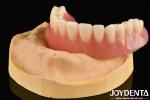 Good Elasticity Acrylic Denture Finish Diverse Tooth Arrangement Technology For