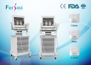 China hifu high intensity focused ultrasound radio frequency face lift machine factory