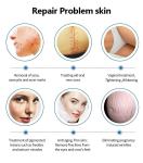 Fractional Co2 Laser Skin Resurfacing Carbon Dioxide Laser Tube Machine