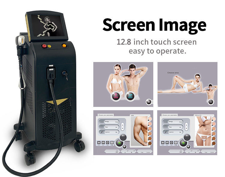 810nm Triple Wavelength Laser Hair Removal 808nm