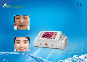 China 30MHz RBS beauty machine laser blood vessel skin tag removal device factory