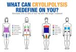 Cryolipolysis slimming equipment cryolipolysis slimming machine cryotherapy fat