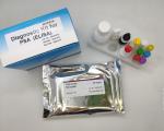 Medical Rapid Diagnostic 96pcs Elisa Test Kit Hbsag Hepatitis B Surface Antigen