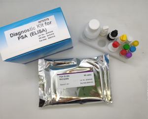 China Hepatitis B Virus Core Antigen Elisa Home Test Kit 96 Pieces factory