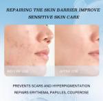 Facial Skincare Collagen Mask Sheet Pack Moisturizing Nourishing Pore Tightening