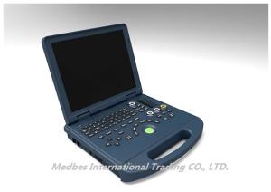 China Clinic Ultrasound Scanner M-C60 Portable Color Doppler Ultrasound System factory