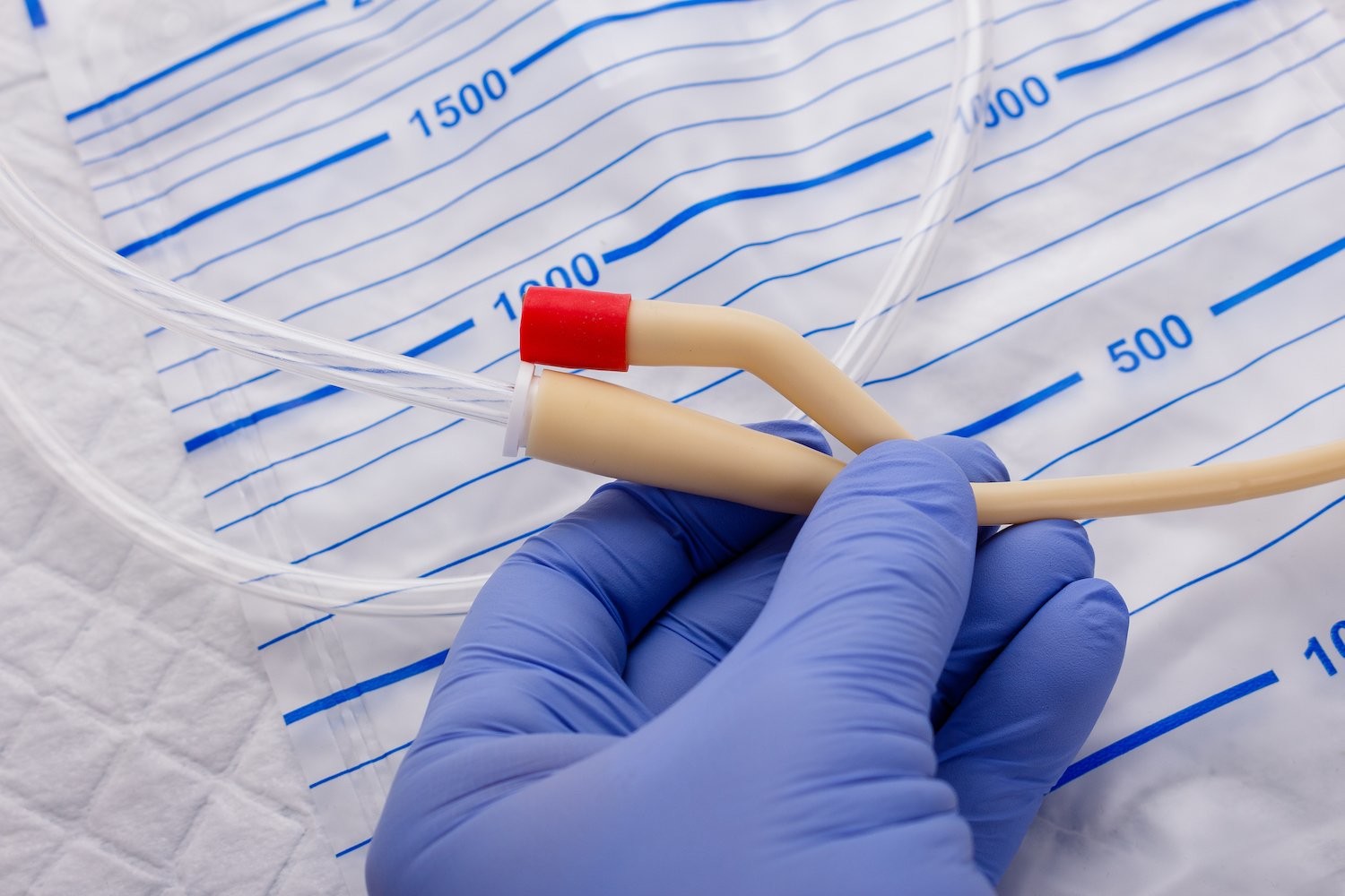 Orcl Female External Disposable Latex Foley Catheter 30cc Balloon FR30