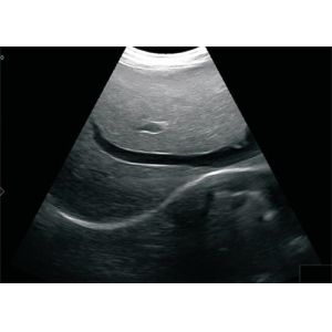 China 12 &quot; LCD Screen Portable Ultrasound Device Digital High Resolution With B, B+B, 4B, B/M M Modes factory