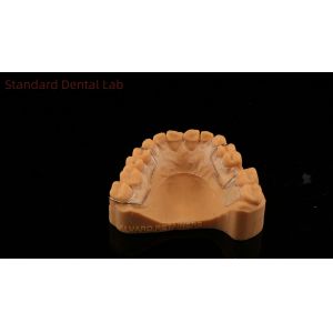 China Perfect Fit Germany Ortho Teeth Halley Retainer for Esthetics and Adjustability Clear Shade SDL Dental Lab on sale