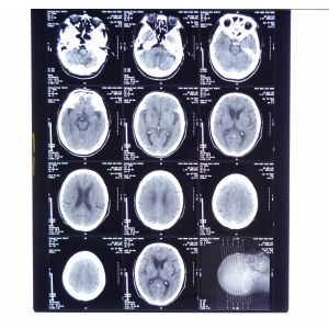 Fuji / Agfa X Ray Film , 8in x 10in Medical Dry Termal Printer Film