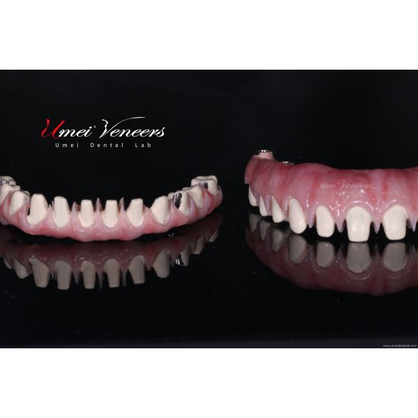 China Good biocompatibility zirconia bridge factory