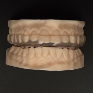 China Clear Hard Soft Orthodontic Night Guard Breathability Heavy Duty Protection Occlusal Splint Hard/Soft factory