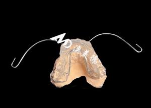 China Versatile Orthodontic Activators The Ultimate Solution for Jaw Alignment and Growth factory
