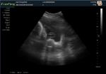 Medical Home Pregnancy Ultrasound Machine DRF RDA Imaging USB Port