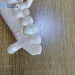 Corrosion Resistant Zirconia Crowns Natural Looking Zirconia Teeth