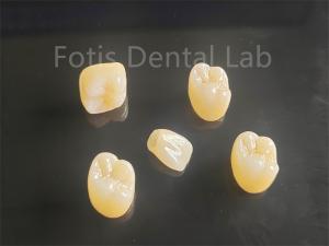 China Aesthetic Appeal Full Porcelain Layered Zirconia Ideal For Crowns Bridges factory