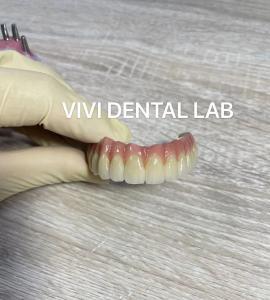 China Digital Dental Implant Crown And Bridge High Esthetics Customized on sale