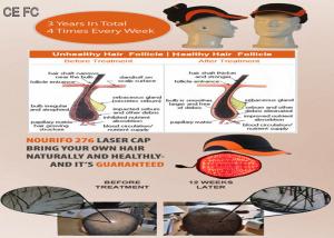 China Hair Loss System Helmet Cold Laser Hair Growth Cap for Hair Growth Faster factory