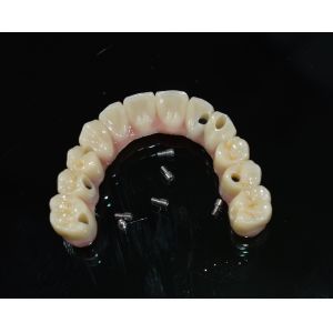 Zirconia Dental Crown: Natural-looking Teeth, Durable & Secure