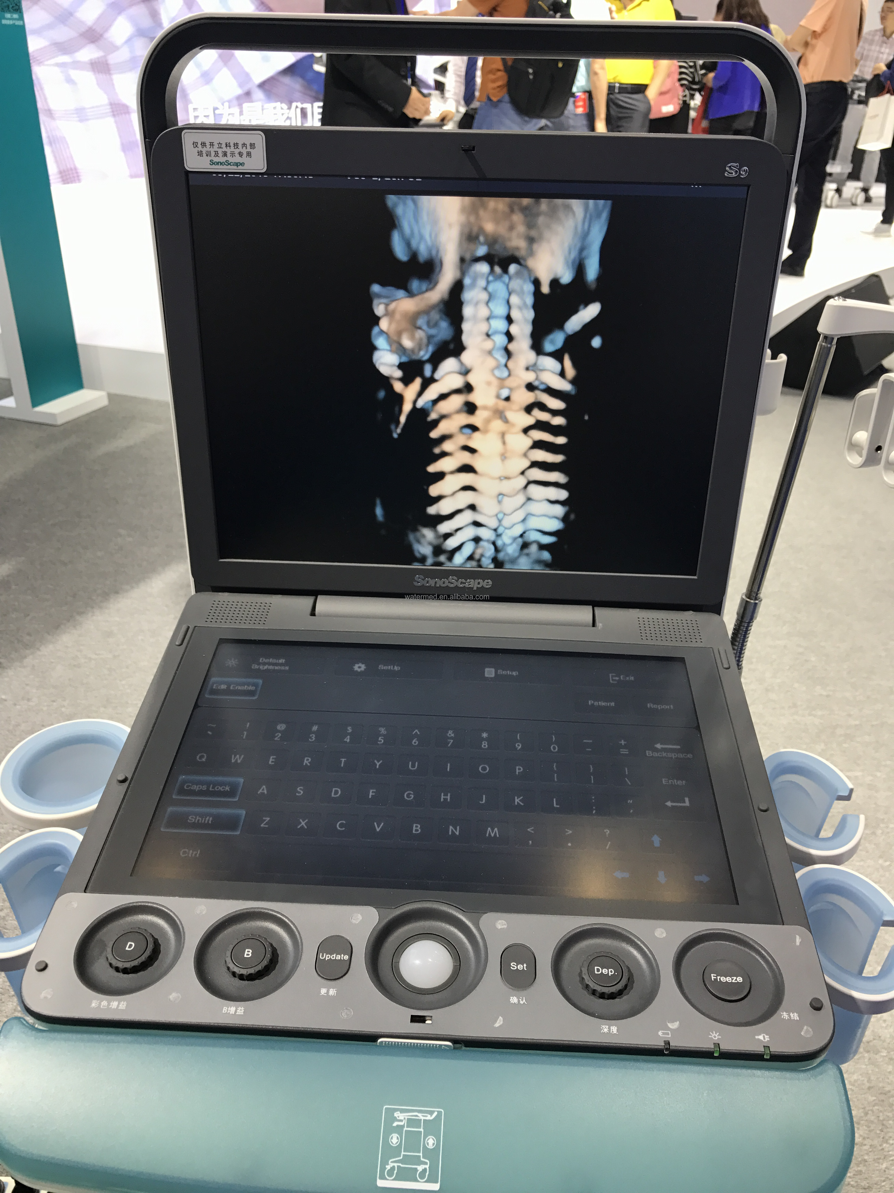 Portable 3D 4D Color Doppler USG&Sonoscape S9
